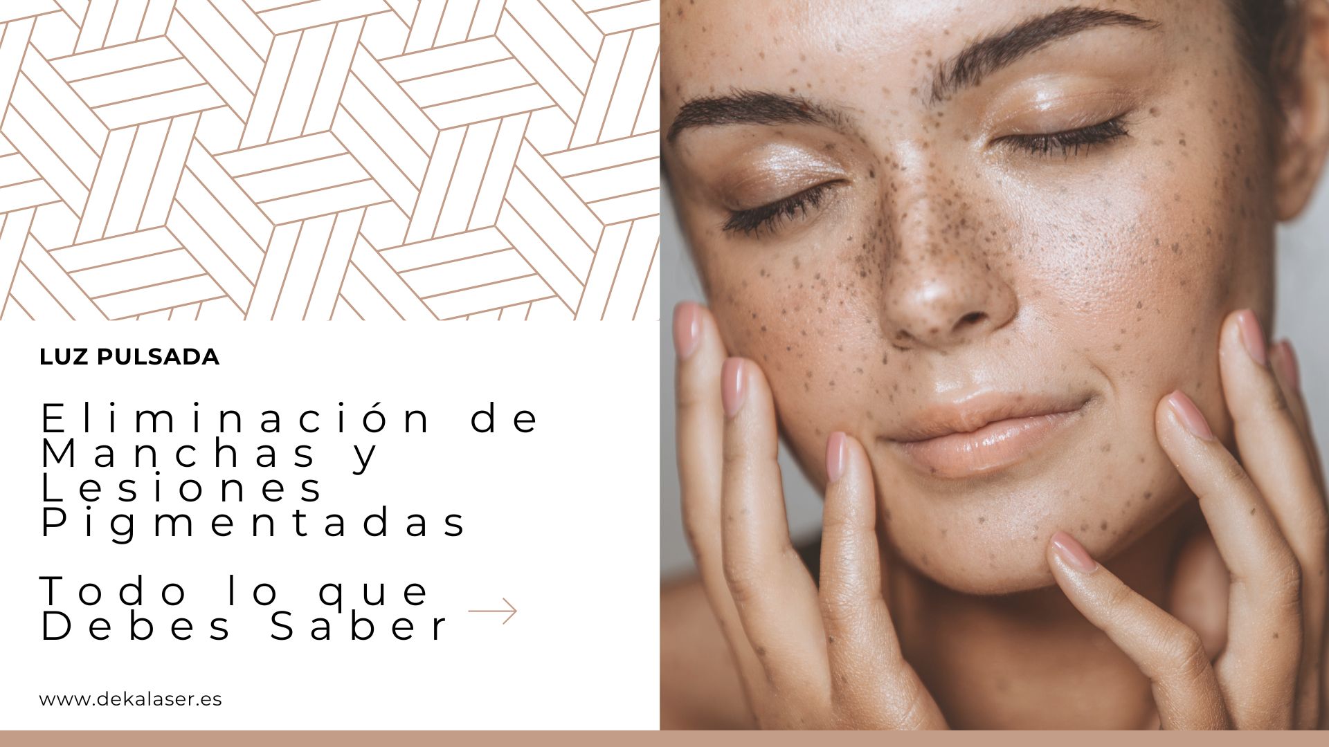 equipo luz pulsada IPL minisilk DEKA