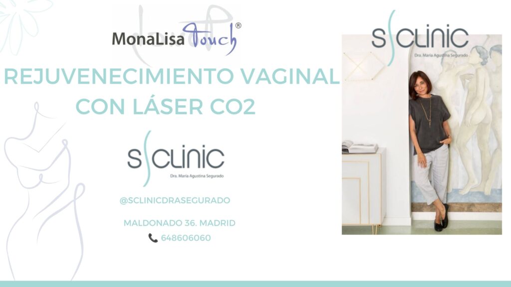 MonaLisa Touch en S Clinic Barrio de Salamanca