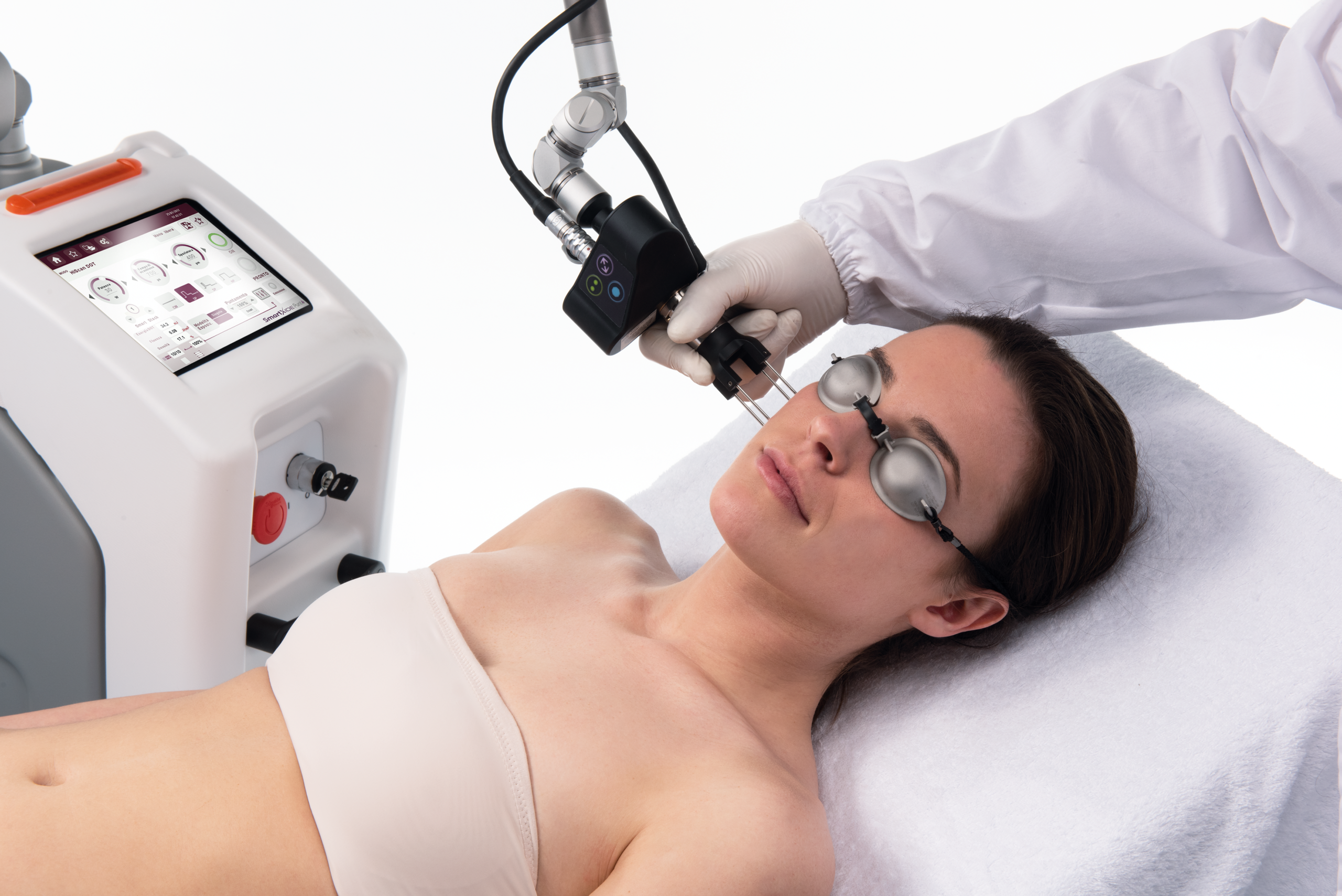 laser co2 ultrapulsado y coolpeel DEKA