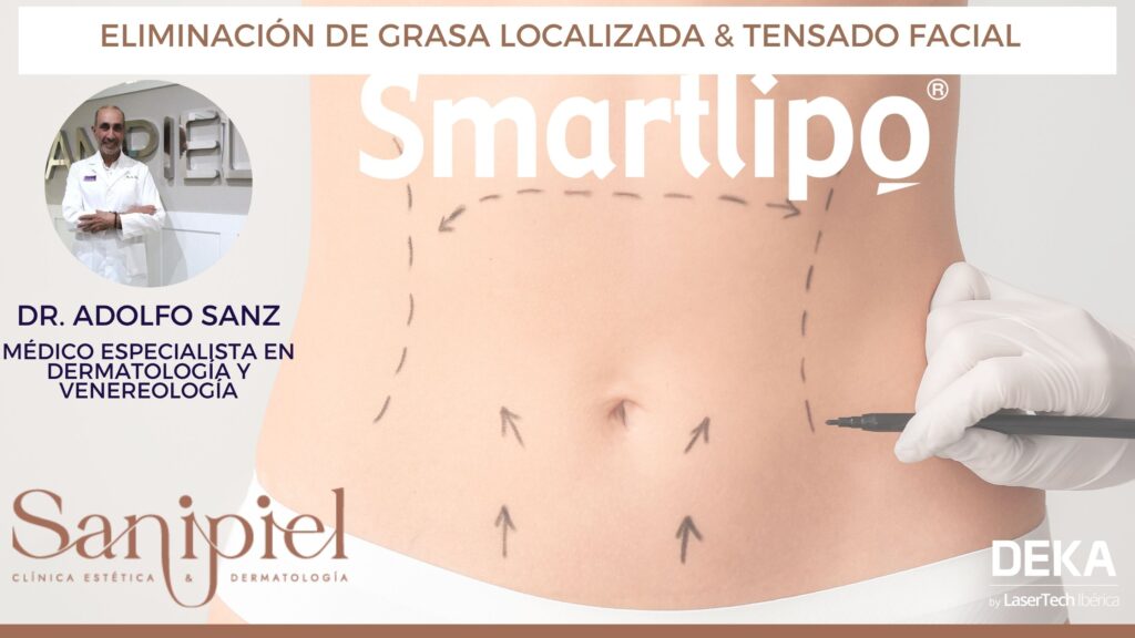 smartlipo Clinica Sanipiel Dr. Adolfo Sanz