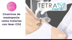 Cicatrices de mastopexia cómo tratarlas con láser CO2 - Tetra Pro DEKA