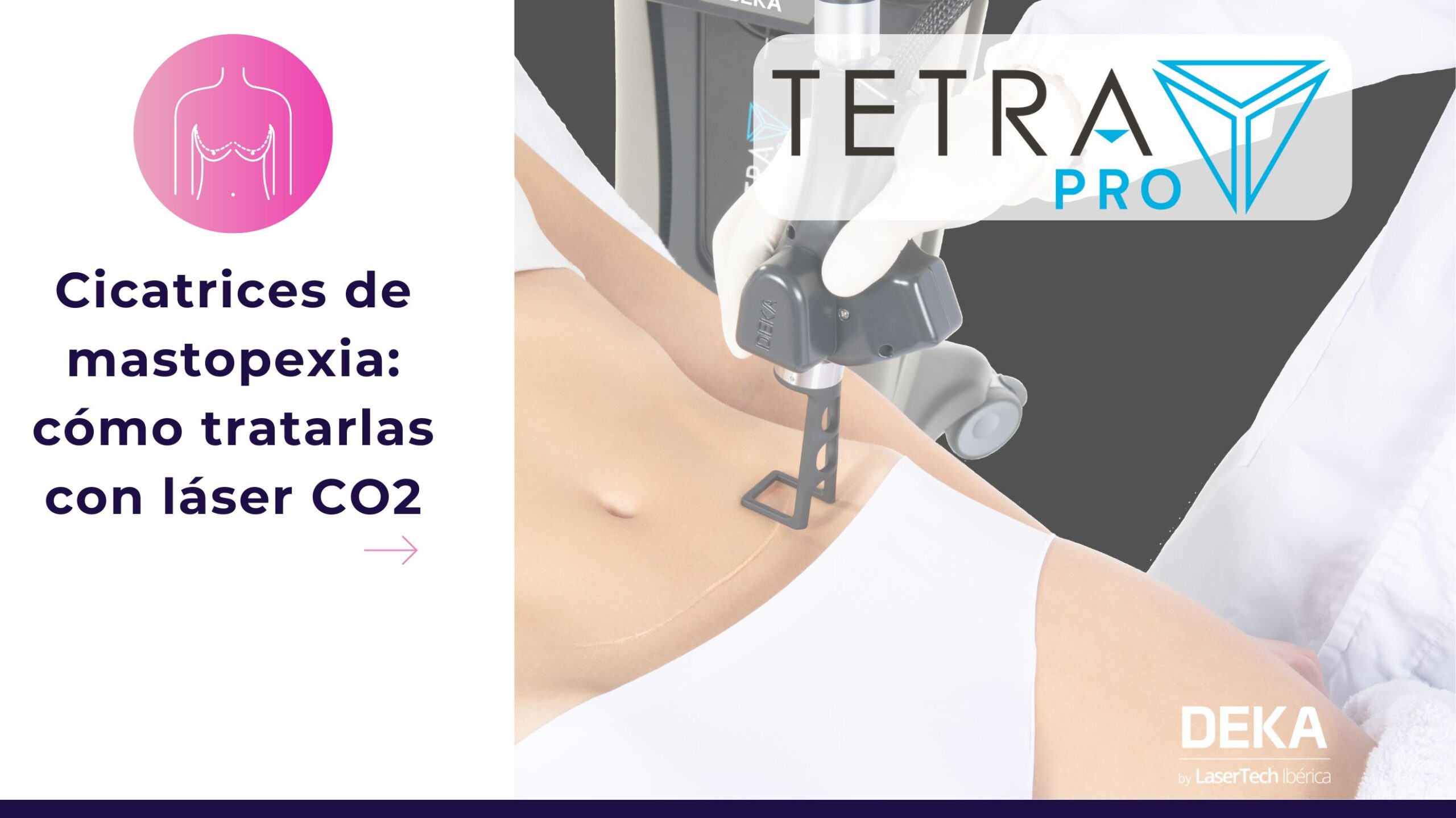 Cicatrices de mastopexia cómo tratarlas con láser CO2 - Tetra Pro DEKA