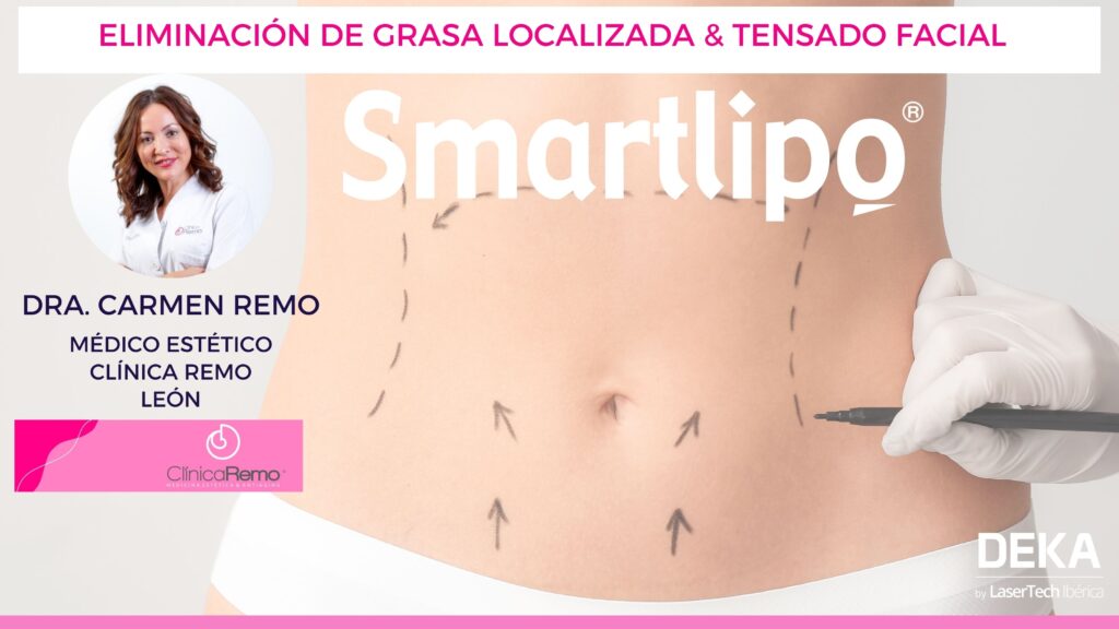Smartlipo laserlipolisis en Clínica Remo Dra. Carmen Remo - Leon