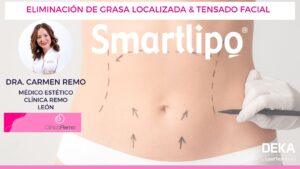 Smartlipo laserlipolisis en Clínica Remo Dra. Carmen Remo - Leon