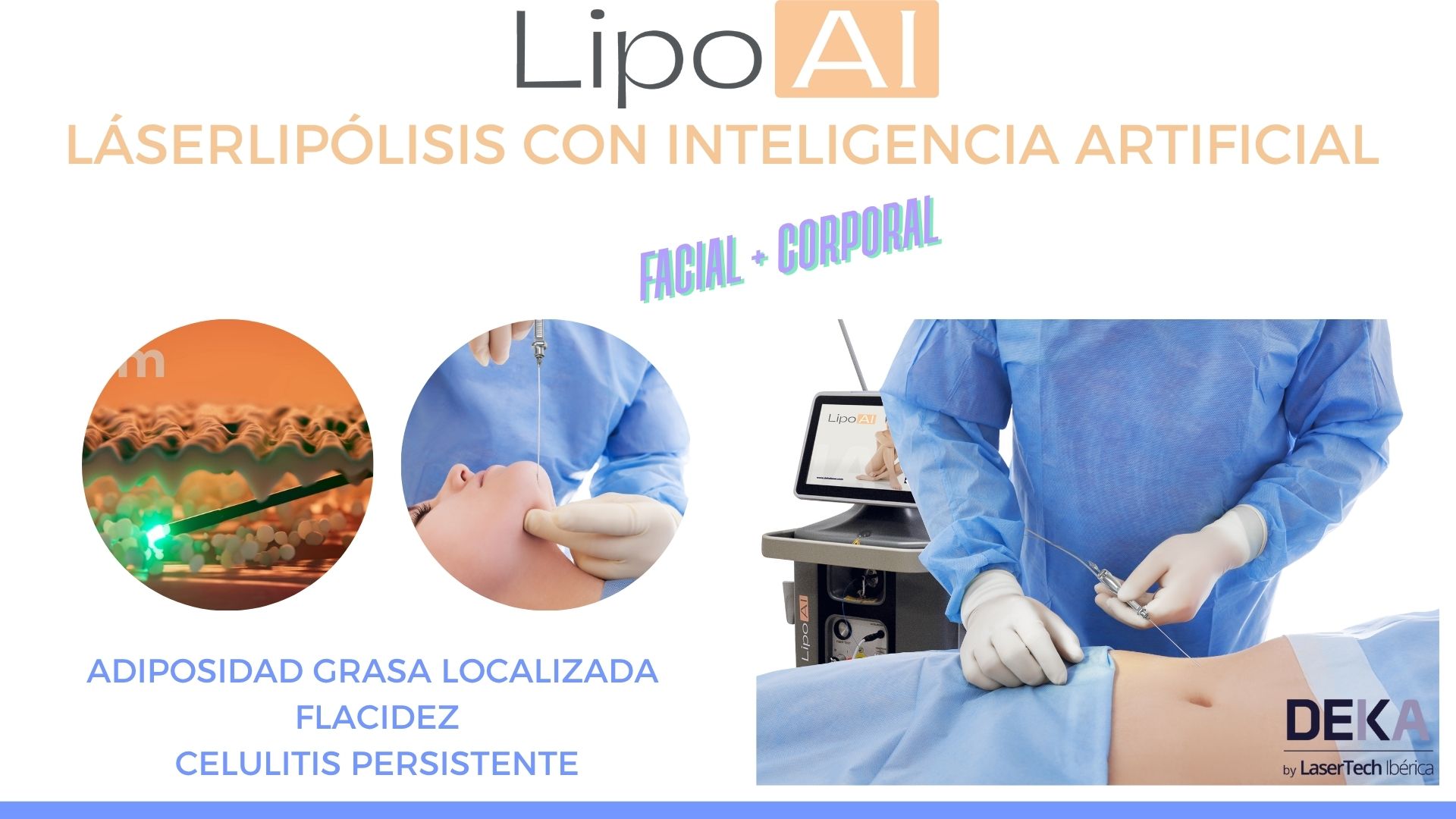 Lipo AI: lipólisis láser de DEKA