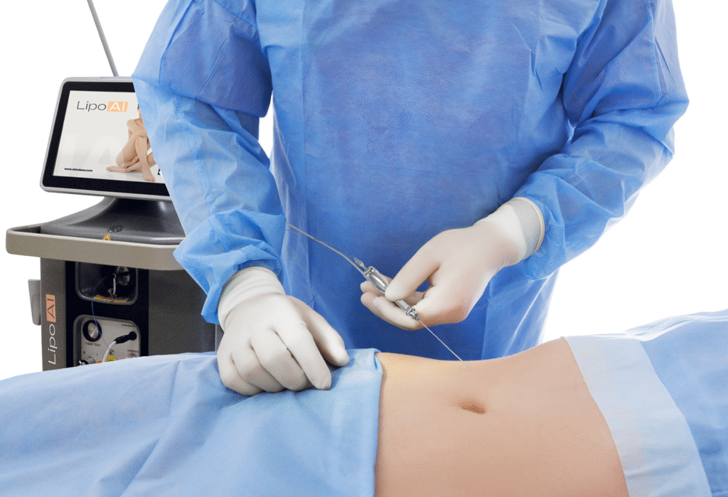 Lipo Ai-lipolaser DEKA tecnología láser para grasa localizada
