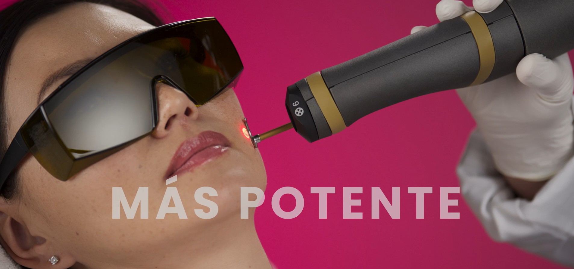 Laser q-switched TORO melasma lesiones pigmentadas DEKA 3