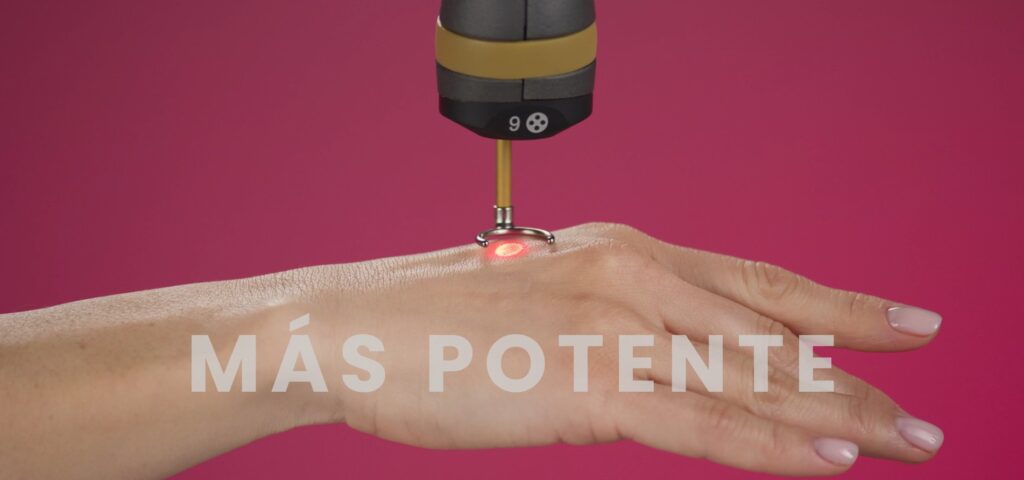 Laser q-switched TORO melasma lesiones pigmentadas DEKA 4 rejuvenecimiento de manos eliminacion de manchas manos