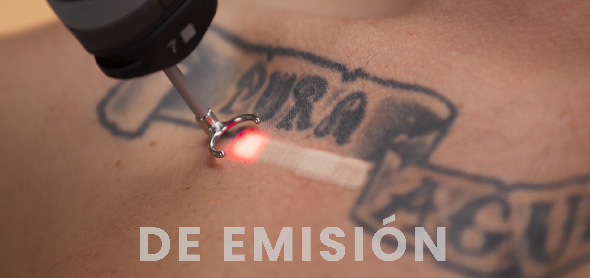 Laser q-switched TORO melasma lesiones pigmentadas DEKA 5