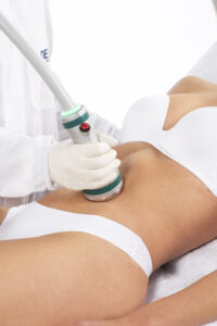 comprar aparatologia medico estetica Onda DEKA celulitis 
