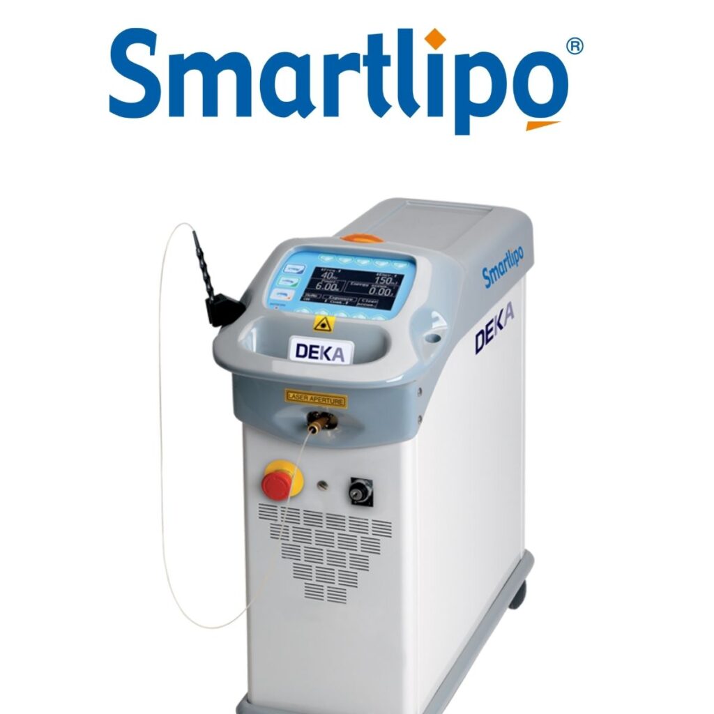Laserlipólisis Smartlipo reduce grasa localizada y reafirma la piel con mínima invasión y recuperación rápida. Ideal para clínicas médico-estéticas.