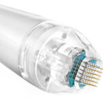 Radiofrecuencia con microagujas vivace para estrias, poros, flacidez