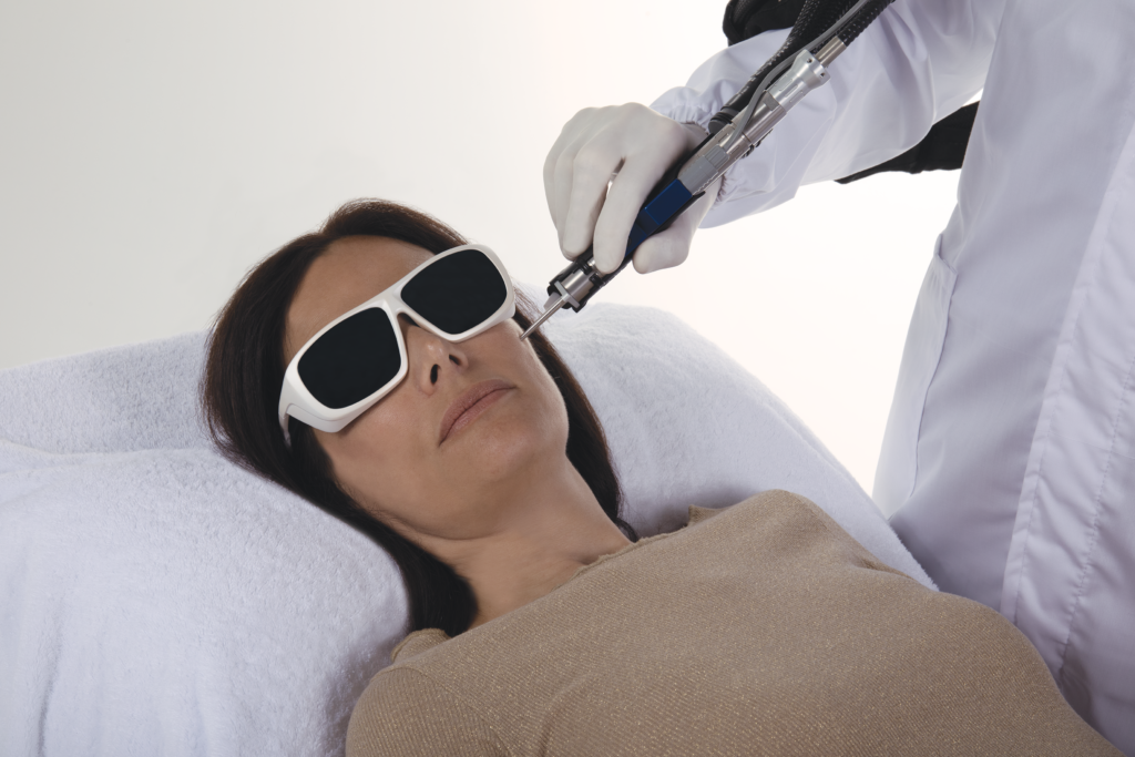 colorante pulsado - PDL DEKA laser medico Synchro VasQ DEKA