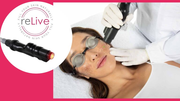 laser lejuvenecimiento colageno, vascular y melanina. Relive DEKA