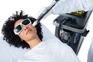 MoveoGlo DEKA tratamiento laser de rejuvenecimiento