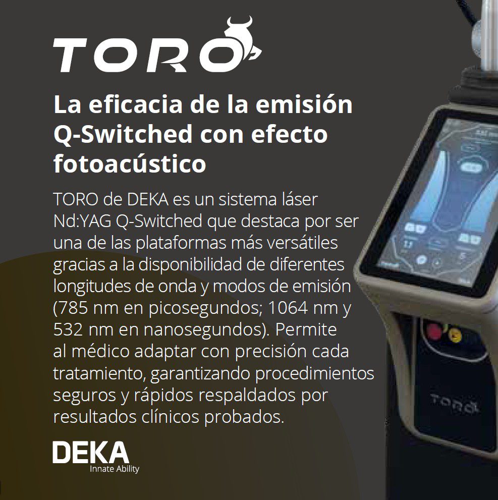 laser TORO de deka Picosegundo y Nanosegundo; 3 longitudes de onda: 785 nm, 532 y 1064 nm