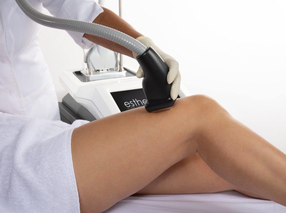depilacion laser diodo