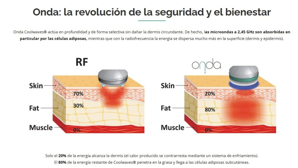 Onda Coolwaves® actúa en profundidad y de forma selectiva sin dañar la dermis circundante. De hecho, las microondas a 2,45 GHz son absorbidas en particular por las células adiposas, mientras que con la radiofrecuencia la energía se dispersa mucho más en la superficie (dermis y epidermis).