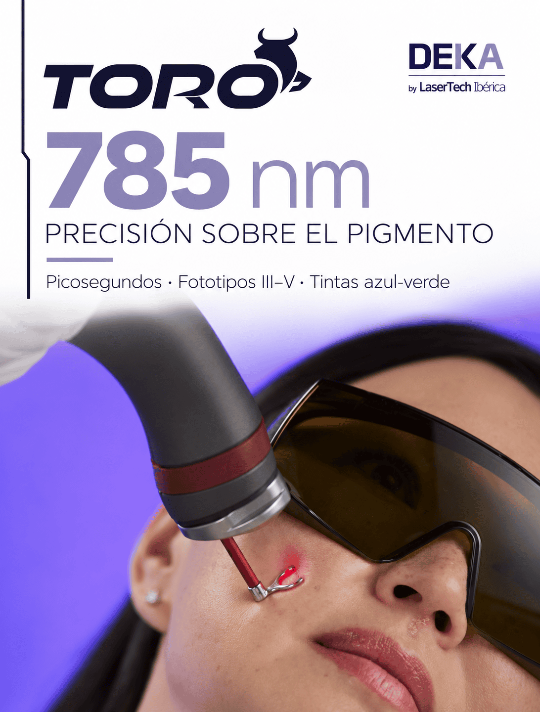 longitudes de onda 532, 785 y 1064 nm del láser TORO de DEKA para lesiones pigmentadas y tatuajes.