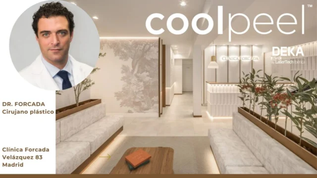 CoolPeel en Clínica Forcada: rejuvenecimiento facial con láser CO₂ DEKA sin cirugía ni tiempo de baja

La medicina estética evoluciona constantemente, y CoolPeel representa una de las innovaciones más avanzadas en rejuvenecimiento facial no invasivo. En Clínica Forcada (@clinicaforcada), este tratamiento se realiza con el prestigioso láser CO₂ de DEKA Smartxide Punto, una tecnología líder que permite mejorar la textura, el tono y la firmeza de la piel sin los efectos secundarios típicos de otros láseres.

¿Qué es CoolPeel?
CoolPeel es un procedimiento basado en láser fraccionado CO₂, diseñado para ofrecer todos los beneficios de un resurfacing tradicional pero con mínimo tiempo de recuperación. A diferencia de los tratamientos agresivos, CoolPeel utiliza pulsos cortos y precisos que vaporizan la capa más superficial de la piel sin dañar el tejido circundante, promoviendo una regeneración controlada.

🖥️ En nuestra página web www.dekalaser.es encontrarás la nota completa sobre el tratamiento CoolPeel en Clínica Forcada.
Descubre todos los beneficios y por qué el láser CO₂ de DEKA marca la diferencia. @doctorforcada

#deka #dekalaser #smartxidepunto #co2 #coolpeel #dermatologia #laserco2 #reduccióndearrugas #lesionespigmentadas #marcasdeacné #cicatrices #manchasenlapiel #blefaroplastia #manchasdesol